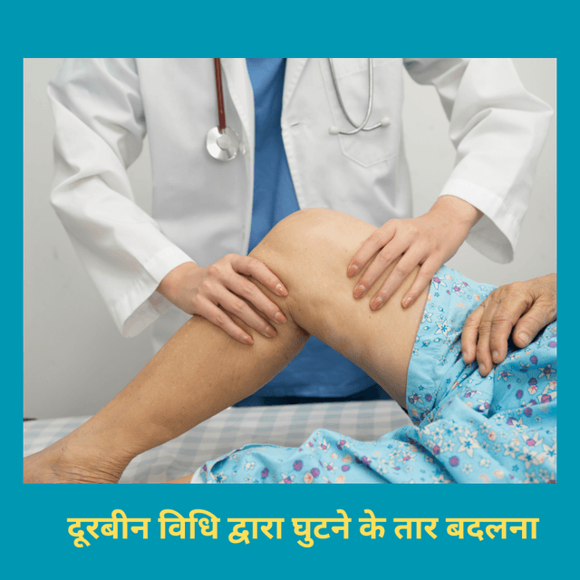 दूरबीन विधि द्वारा घुटने के तार बदलना