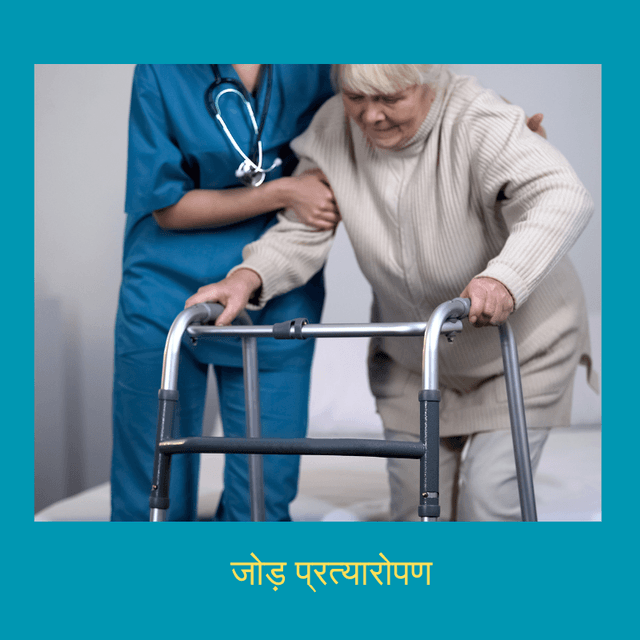 जोड़ प्रत्यारोपण